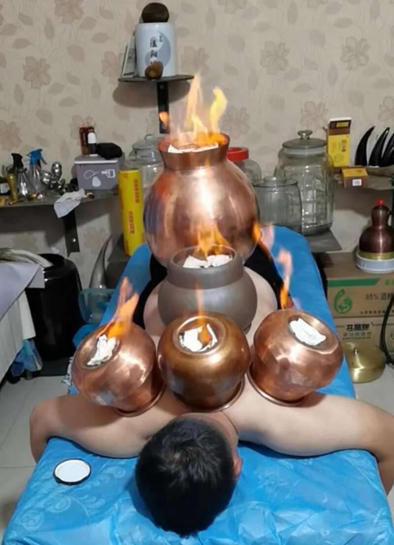 中医版的人体盛：试过火锅式拔罐，尸气都拔出来了（组图） - 16
