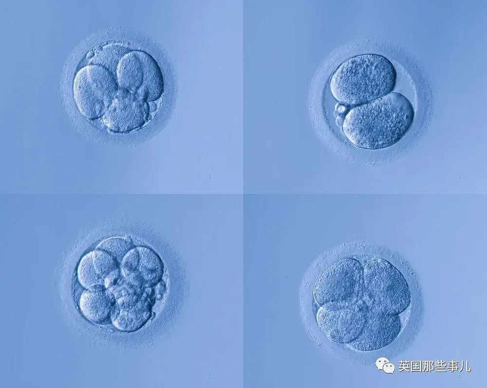 无需精子卵子，科学家成功合成出人类胚胎？人造宝宝指日可待（组图） - 15