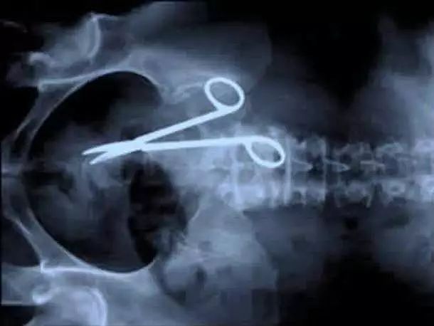 X光下的人体，竟发现有个“炮弹”塞在直肠里...（组图） - 21