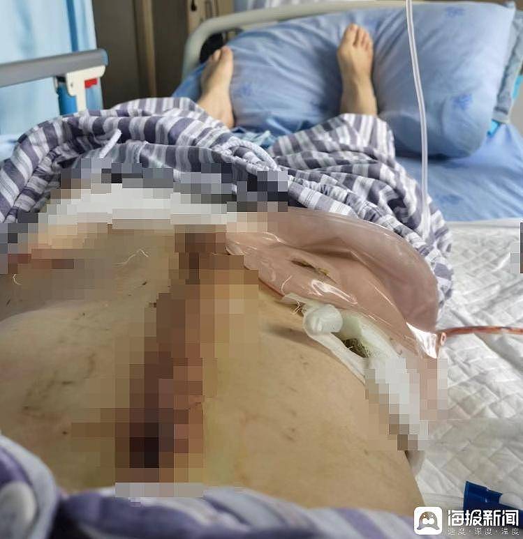 两年被家暴16次：为什么我逃也逃不了，离也离不掉？（组图） - 1