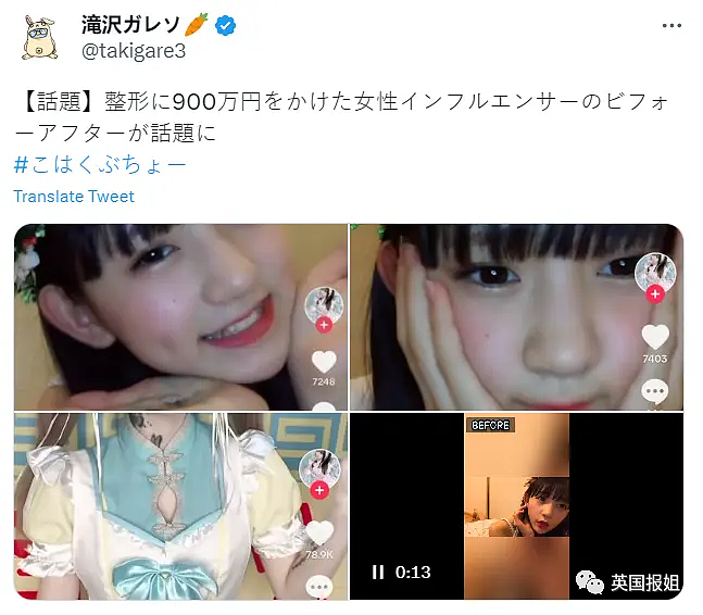 15岁日本美少女网红整容失败，对比照震惊网友！母亲竟纵容她花900万“换头”（组图） - 1