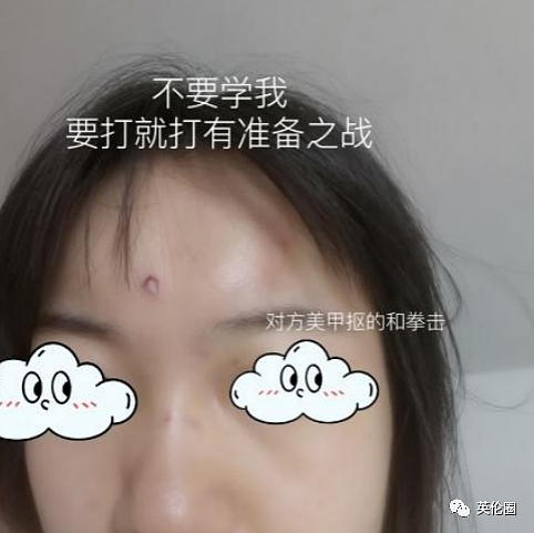 中国女留学生自曝遭种歧殴打，当街被摁住手脚掐脖子，险些窒息！“路人冷眼旁观”（组图） - 8