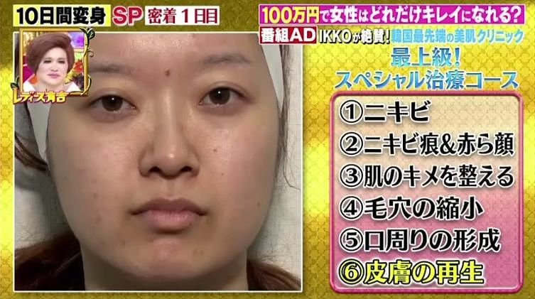 日本2位小姐姐每人100万随便花，不整形不减肥，10天后大变样...有钱真好（组图） - 5