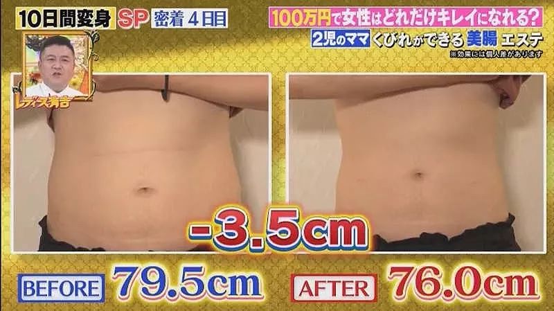 日本2位小姐姐每人100万随便花，不整形不减肥，10天后大变样...有钱真好（组图） - 25