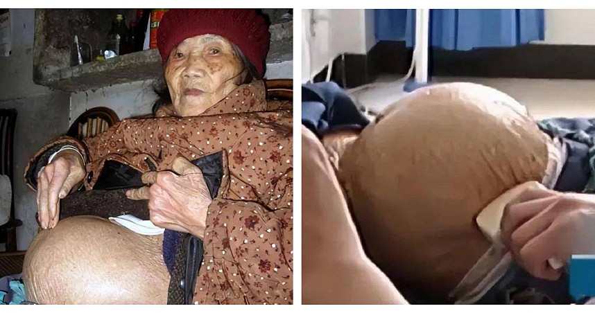 91岁老妇人摔一跤到医院，竟查出怀孕！她摔出深藏60年的秘密（组图） - 1