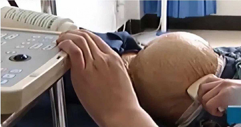 91岁老妇人摔一跤到医院，竟查出怀孕！她摔出深藏60年的秘密（组图） - 5