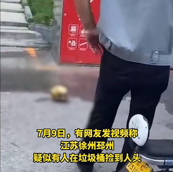 网传有人在江苏医院外垃圾桶捡到人头！内媒：疑为头盖骨（组图） - 3