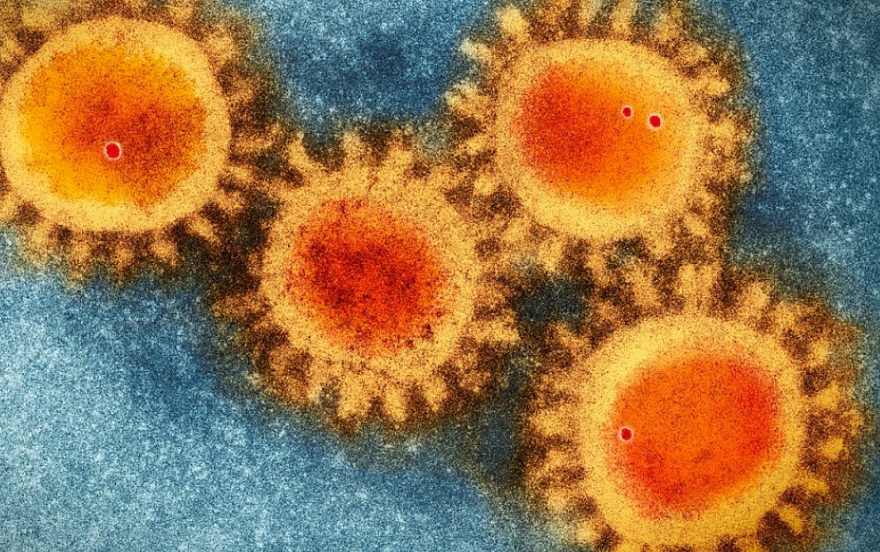 又一病毒在澳快速蔓延，已致近7万人感染！没疫苗可打，重症恐丧命，预防对策收好！这个冬季，“三重病毒威胁”来袭（组图） - 2