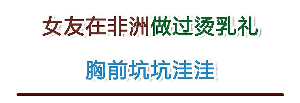 【情感】女友在非洲做过烫乳礼，胸前坑坑洼洼！回了一趟她老家后，才知真相那么恶心（组图） - 1