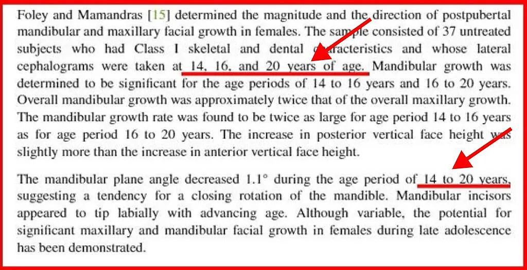下颌骨疯长到40岁？剖析年老“发腮”的真正原因（组图） - 5