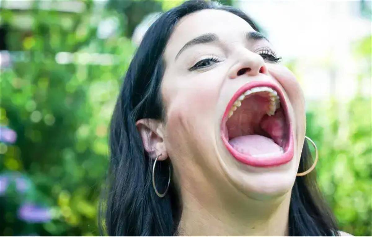 全球嘴巴最大女子再创新纪录！嘴巴最宽！可塞整盒薯条（视频/组图） - 1