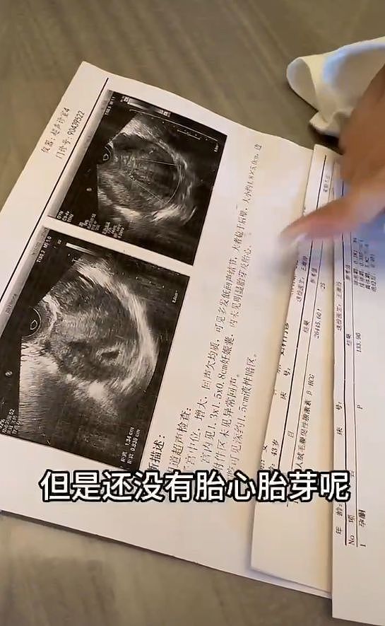 喜讯！43岁网红“虎牙姐姐”官宣怀孕，结婚八年两次试管失败（组图） - 10