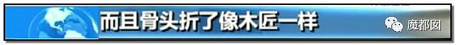 中国医疗圈地震！数百院长被查，1500万设备捞1600万回扣（组图） - 76