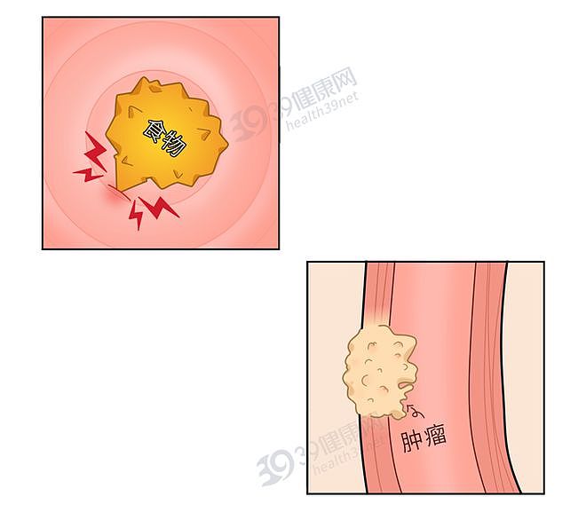 【健康】2种鱼已被列入“致癌名单”，吃多了会致癌？这些才真的要少吃（组图） - 2