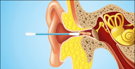 这5种耳朵需要定期“掏”，医生示范专业版“采耳”（组图） - 2