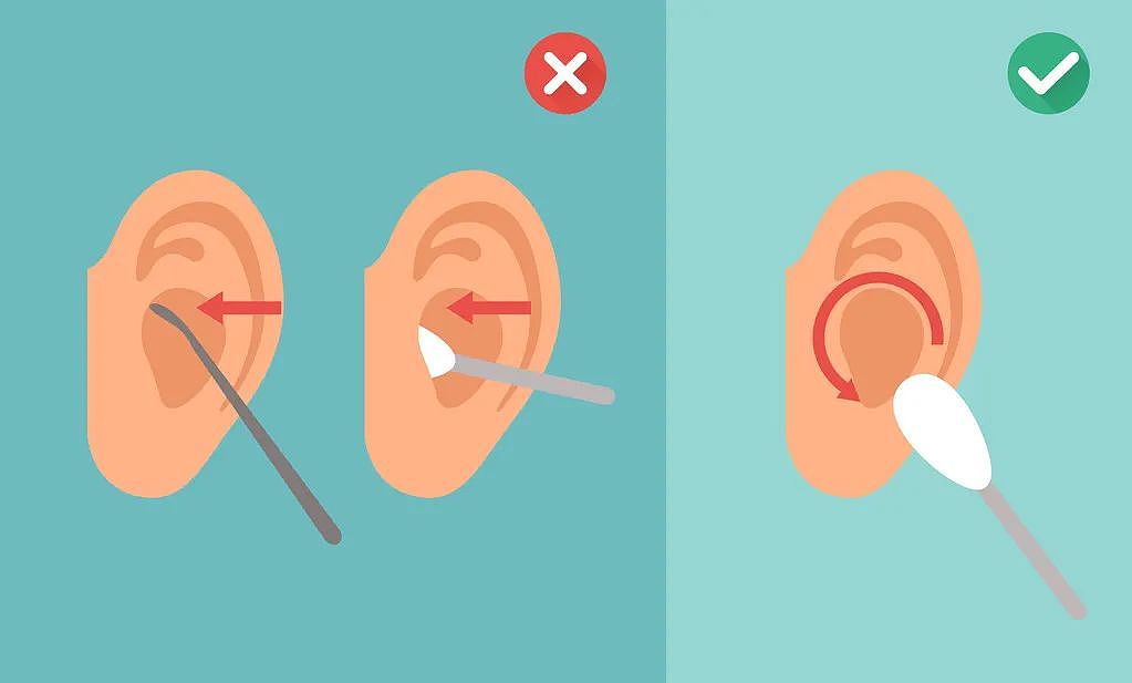 这5种耳朵需要定期“掏”，医生示范专业版“采耳”（组图） - 3