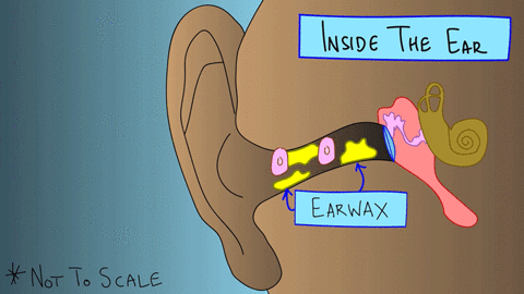 这5种耳朵需要定期“掏”，医生示范专业版“采耳”（组图） - 1