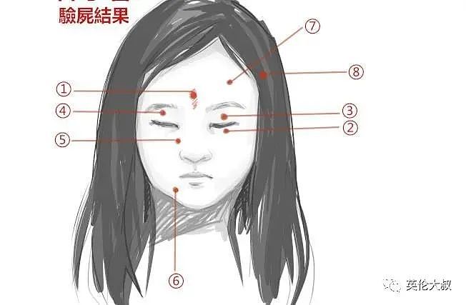 华人医生灭门案：尸体被裹成木乃伊，5岁女儿被8枪爆头！一切的起因竟然是……（组图） - 8