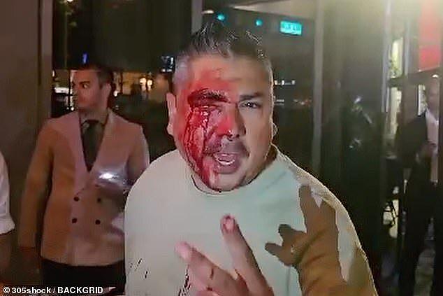 被疑偷拍梅西，男子迈阿密餐厅中被保安打得满脸血，双方各执一词（组图） - 2
