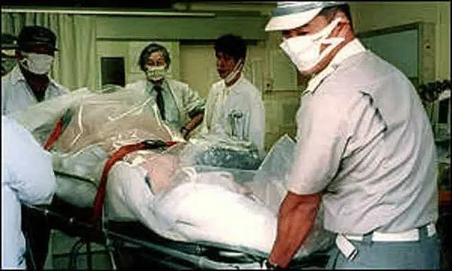 慎入！日本男子遭核辐射，被强行续命83天，亲眼看着自己融化而死（组图） - 2