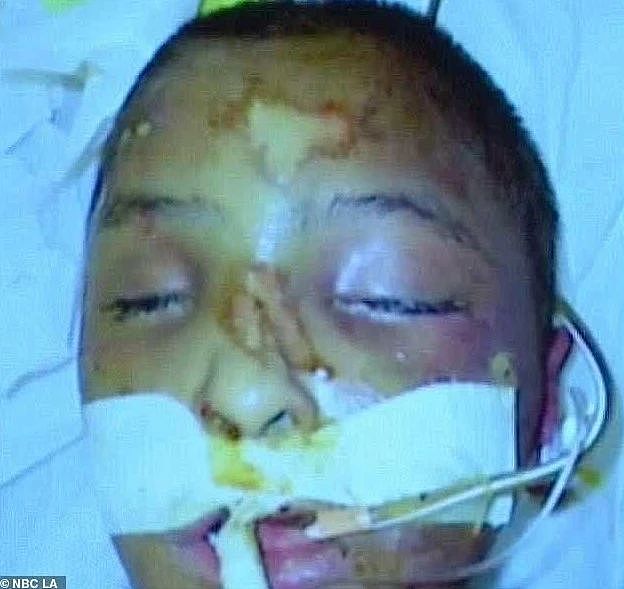 头骨全碎！ 洛杉矶8岁男孩遭亲妈和男友酷刑虐死（组图） - 5