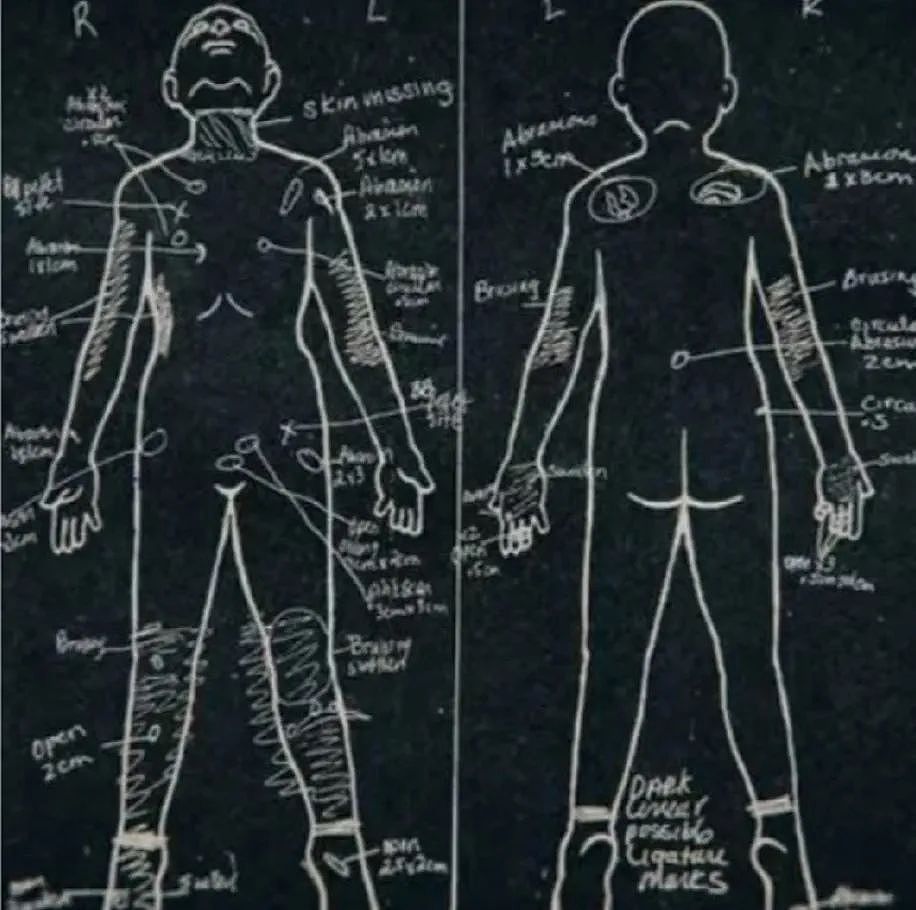头骨全碎！ 洛杉矶8岁男孩遭亲妈和男友酷刑虐死（组图） - 3