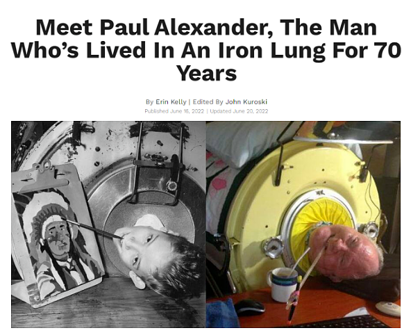 难以置信！男子创造记录：在“铁肺”里生活了70年，断电意味着死亡......（组图） - 1