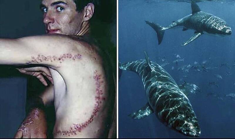 “鲨笼“之父曾遭大白鲨袭击！脏器外漏缝462针（图） - 1