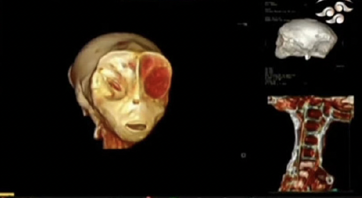离大谱！墨西哥展出两具“外星人尸体”遭质疑，网友：照着ET长的，太刻板印象了...（组图） - 12