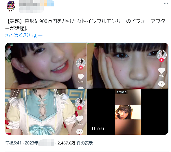日本一15岁美少女整容失败变“蛇精”，幕后推手竟是她亲妈？网友：无语（组图） - 21