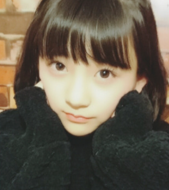 日本一15岁美少女整容失败变“蛇精”，幕后推手竟是她亲妈？网友：无语（组图） - 2