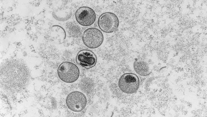 内地首次报告5例女性猴痘病例，专家：未来可能出现家庭内传播（图） - 1