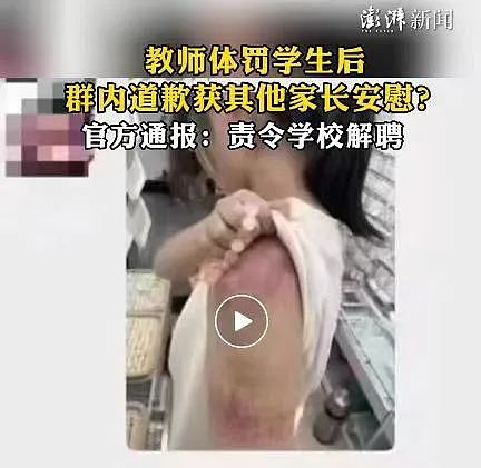 真相竟然如此可怕！被老师敲碎头骨的女孩醒了：老师是故意的，打了两次（组图） - 9