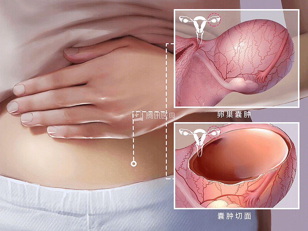 13岁初中女生肚子隆起爬满“妊娠纹”，照完CT，妈妈和医生当场吓懵（组图） - 5