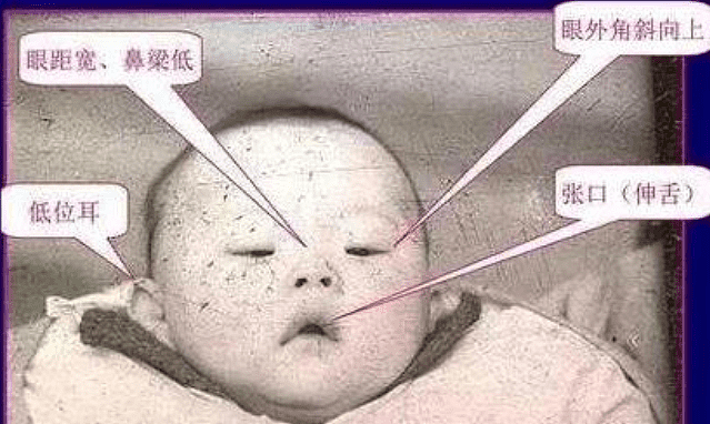 澳洲华人妈妈准备生唐氏宝宝，网友劝她去堕胎：太不负责任了，放他走吧...（组图） - 12