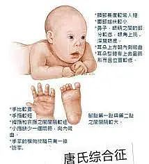 澳洲华人妈妈准备生唐氏宝宝，网友劝她去堕胎：太不负责任了，放他走吧...（组图） - 14