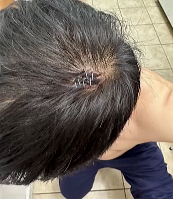 13岁华裔男孩遭校园霸凌！双方父母械斗头破血流，大批华人街头发声（组图） - 6