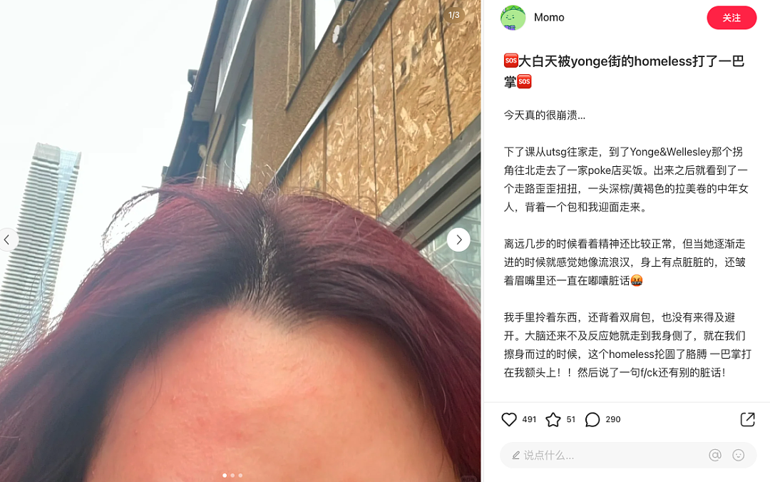 可怕！中国留学生当街遇袭，华人自曝反击经历：怒踹两脚（组图） - 1