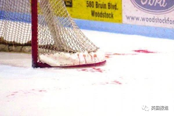 知名运动员比赛中遭冰刀割喉身亡！血洒冰场超惨烈，网友：最害怕的事成真了（组图） - 25