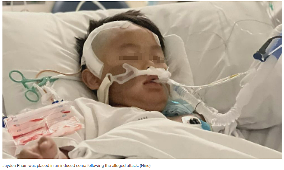天！墨尔本东南区7岁男孩校园内被打至脑出血，还有孩子讨糖时被捅伤...（组图） - 7
