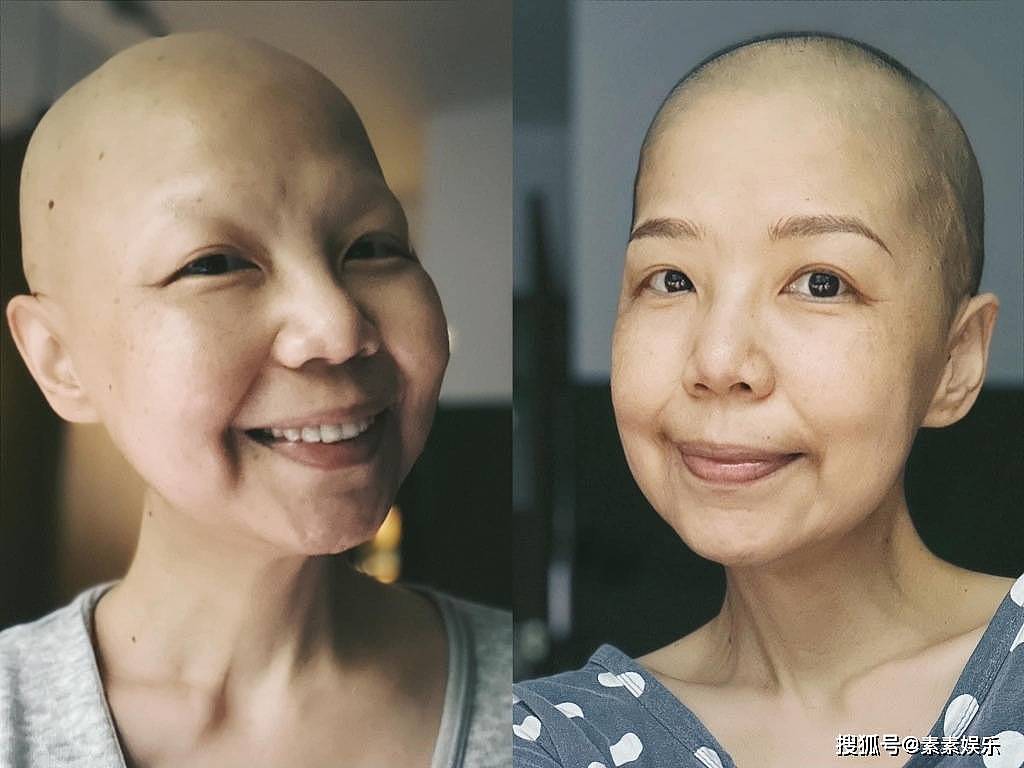 噩耗！导演陈慧翎患宫颈癌离世，年仅48岁，生前最后治疗照公开（组图） - 2