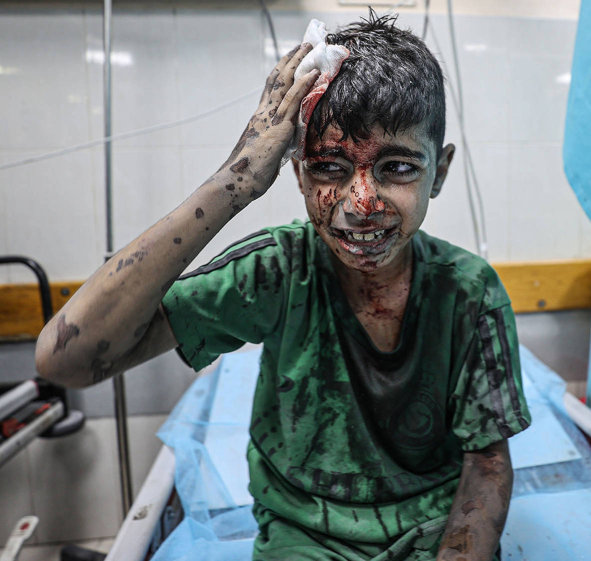 巴以冲突：儿童死伤已过万！加沙成儿童“坟场”（组图） - 3