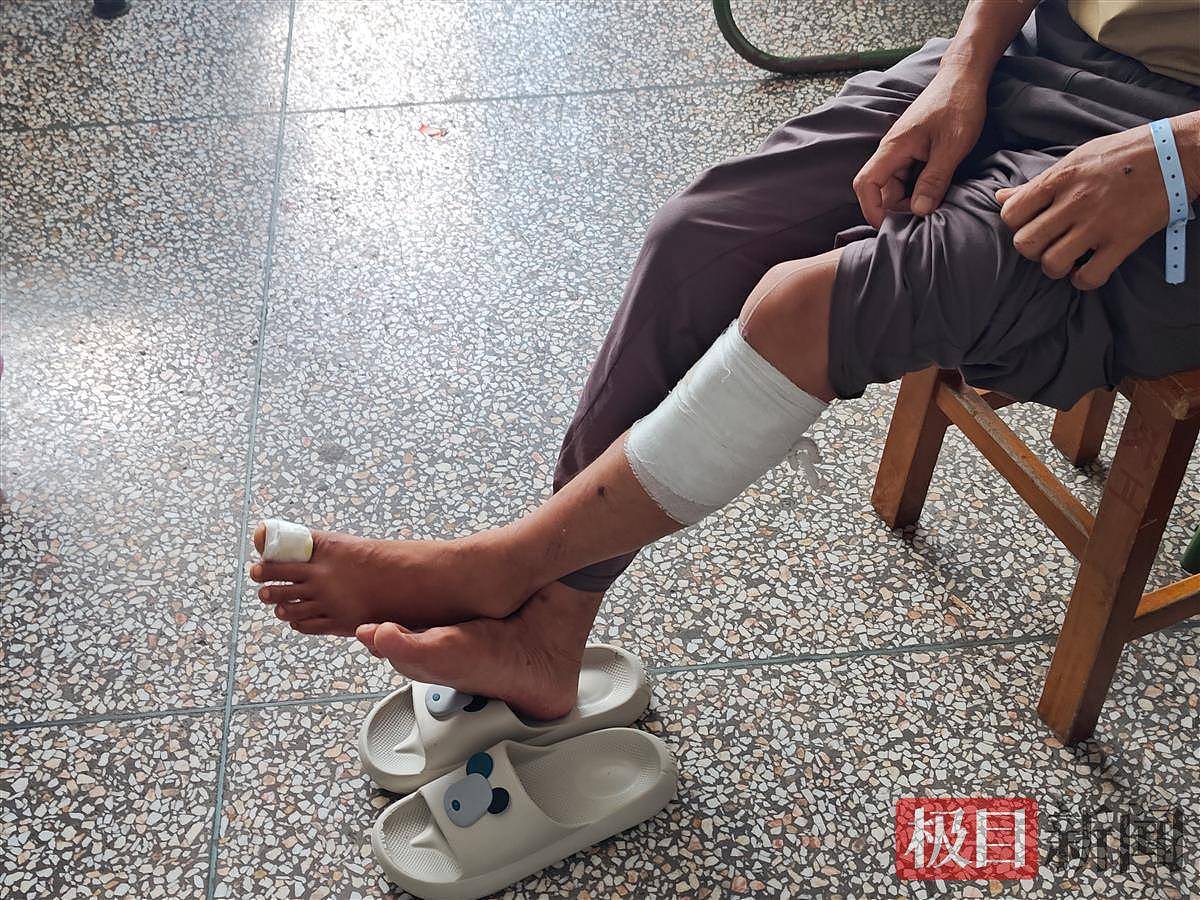 缅北四岁半男童被炮弹炸伤来中国治疗，亲历者：炮弹击穿屋顶落在客厅，一家三人受伤（组图） - 2
