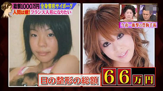 被同学欺凌、被亲爸说丑！日本小姐姐17岁开始整容，花费2亿变成这样...网友：好吓人（组图） - 5