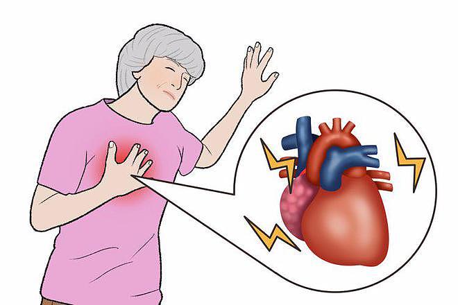 【健康】200万人研究发现：心跳快慢和寿命的关系，60岁后心率多少比较好（组图） - 5