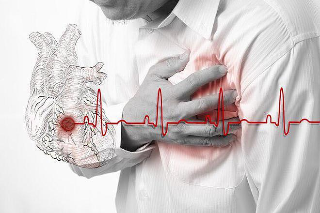 【健康】200万人研究发现：心跳快慢和寿命的关系，60岁后心率多少比较好（组图） - 4