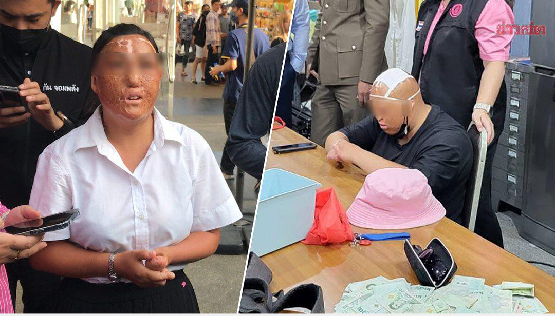 中国乞丐在泰月收入180万！有人被砍双手、烧脸、硫酸毁容！或涉人口贩卖（组图） - 4