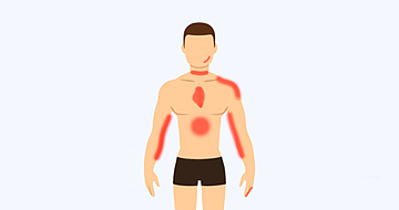 5个部位疼可能是心梗前兆，接下来两个月要格外小心（组图） - 8