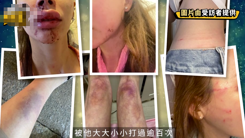 香港男教练在家中“虐待”混血嫩模女友：2年100次，太狠了…（组图） - 8