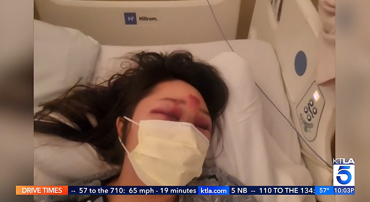 华女在Costco遇袭，被劫匪拖行50米！浑身是血，重伤送医（组图） - 4